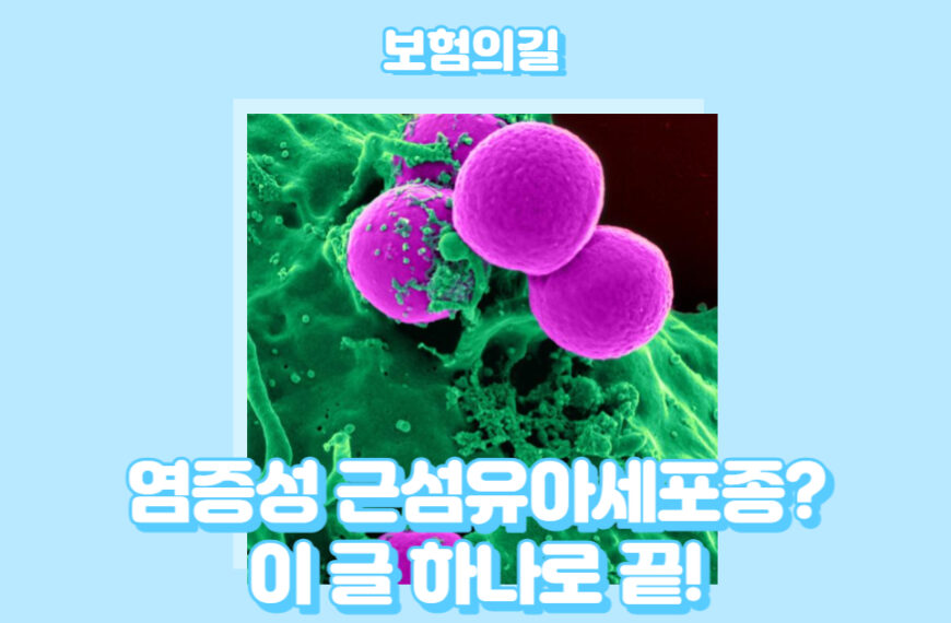 염증성 근섬유아세포종